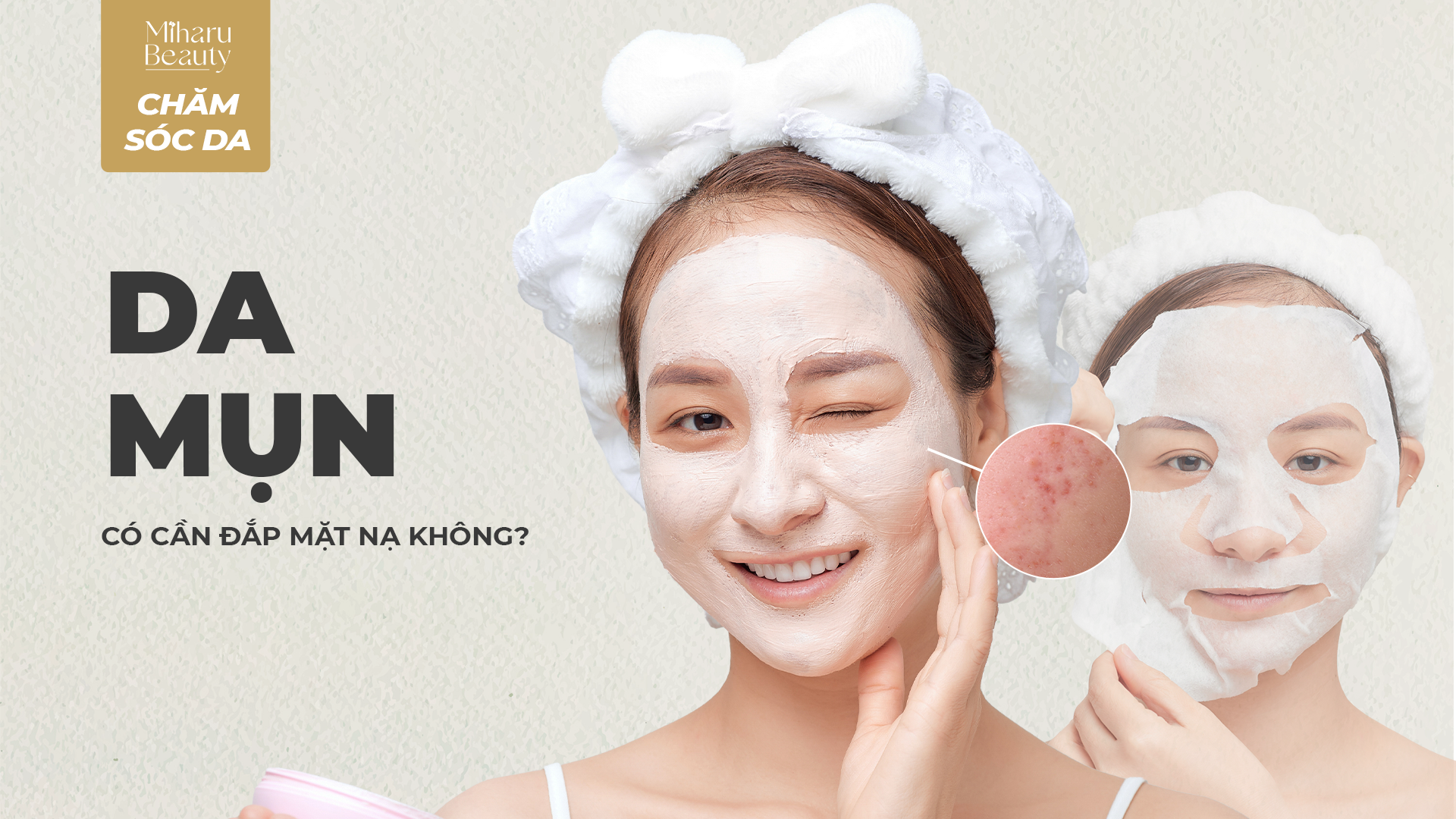 DA MỤN CÓ CẦN ĐẮP MẶT NẠ KHÔNG?